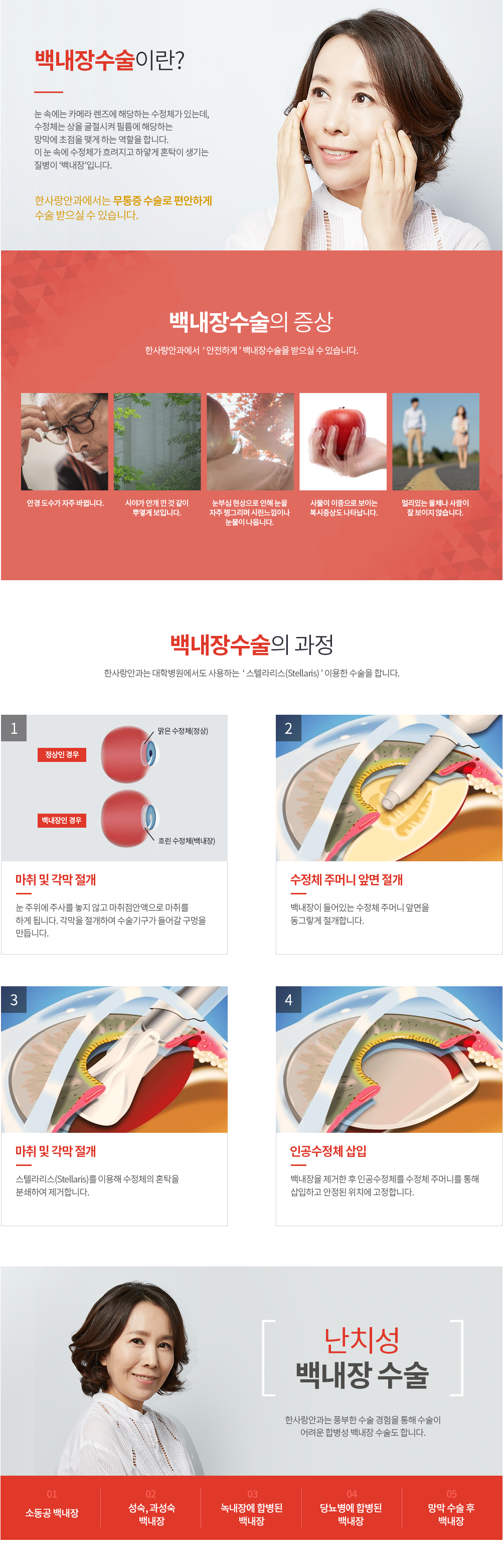 백내장 수술