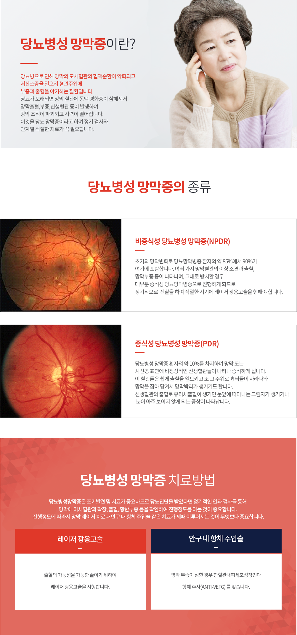 당뇨병성 망막증