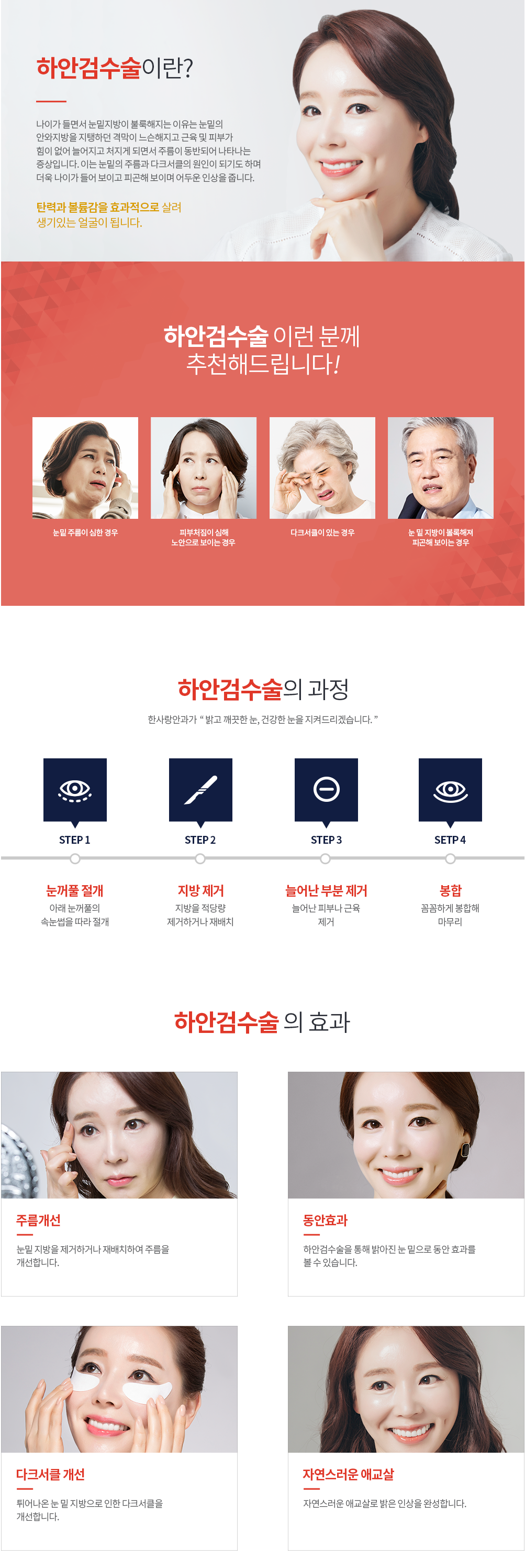 하안검수술