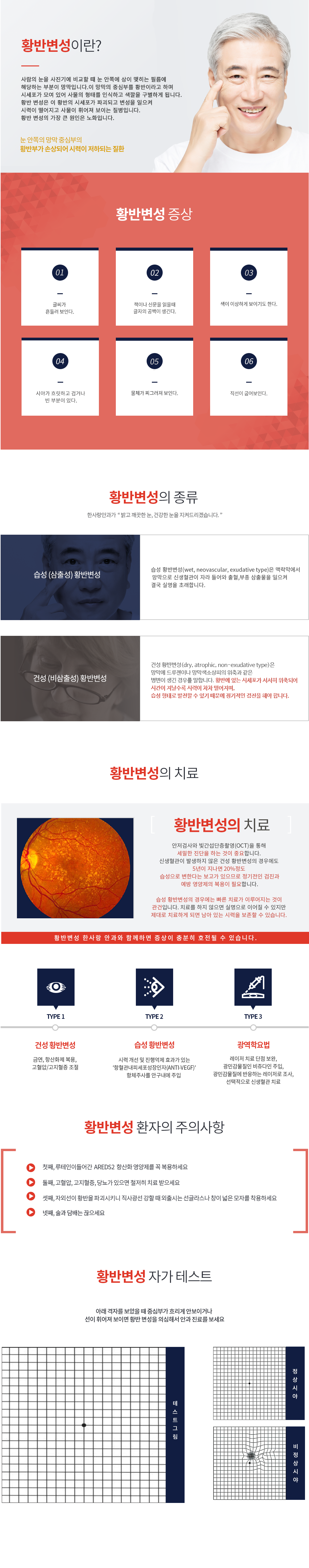 황반변성