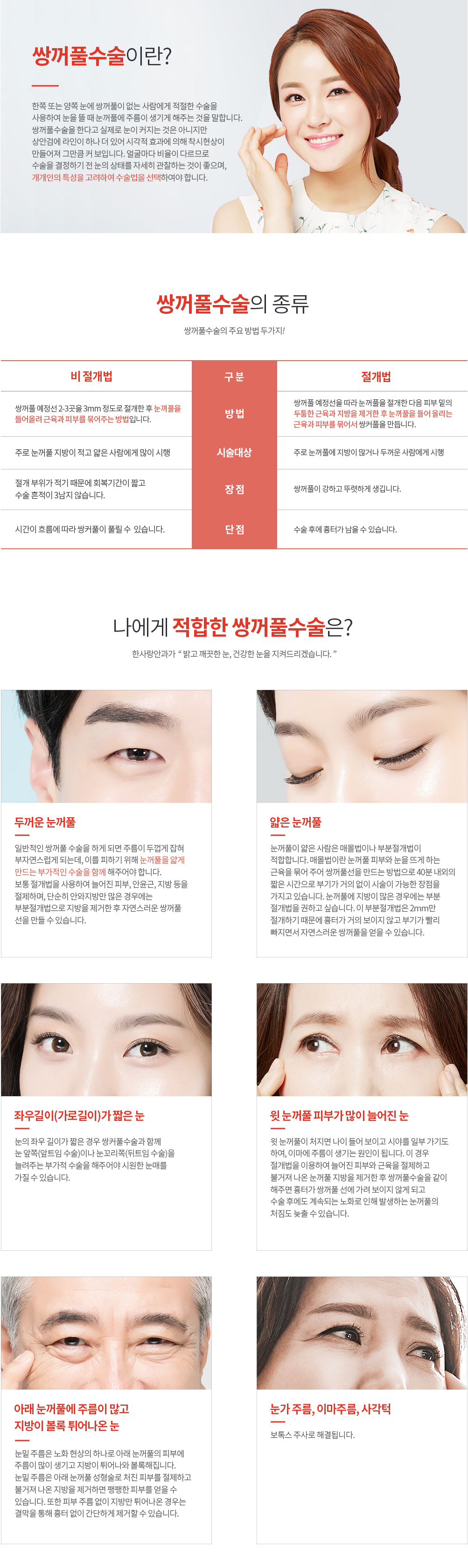 쌍거풀 수술