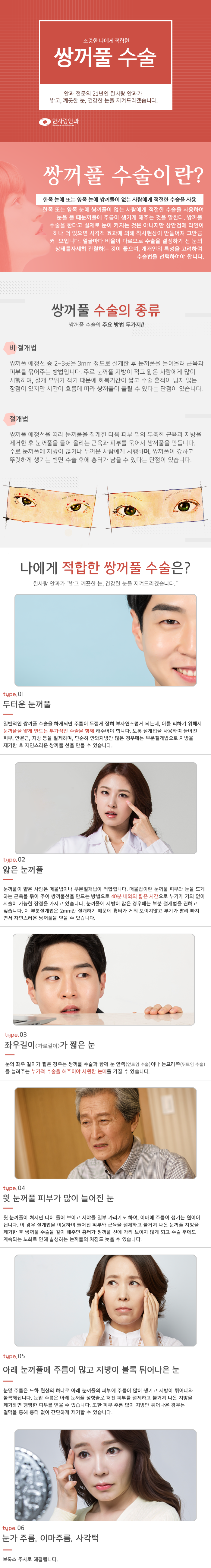 쌍꺼풀수술
